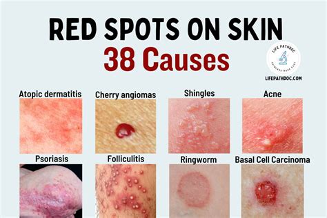 13 Causes Of Red Spots On Skin