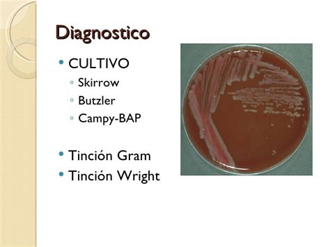 17 Campylobacter Jejuni