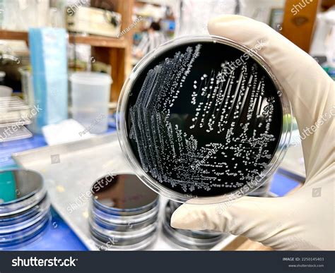 5 Campylobacter Jejuni Colony Images Stock Photos Vectors Shutterstock