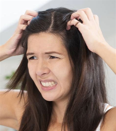 5 Natural Ways To Treat Itchy Scalp Lifeberrys Com