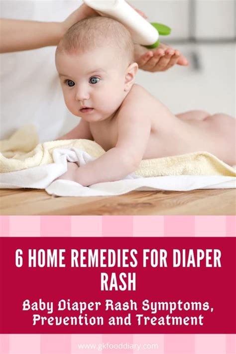 6 Home Remedies For Diaper Rash In Babies Baby Diaper Rash Symptoms