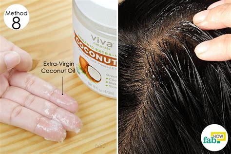 8 Best Home Remedies For Dry Flaky Scalp That Work Fab How