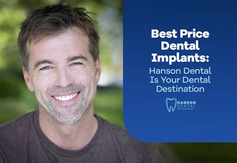 Best Places for Dental Implants