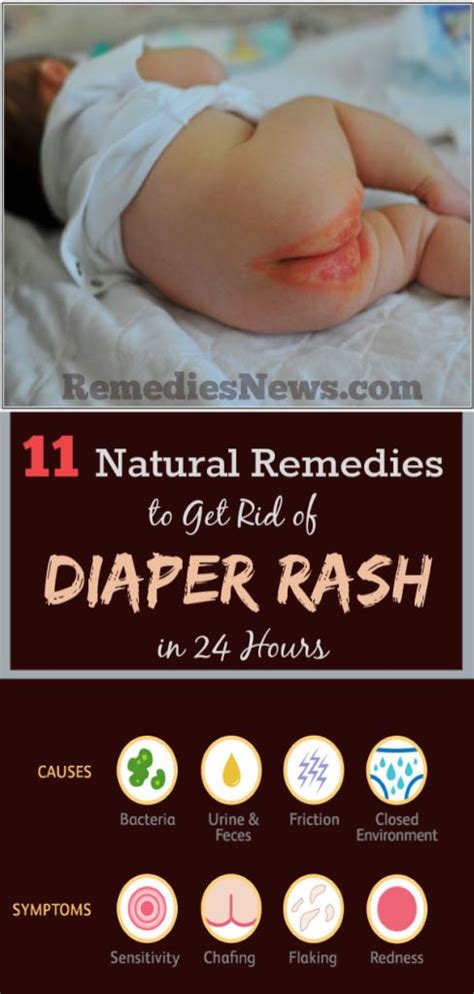 Bleeding Diaper Rash Remedies Baby Remedies Diaper Rash Remedy Rashes Remedies