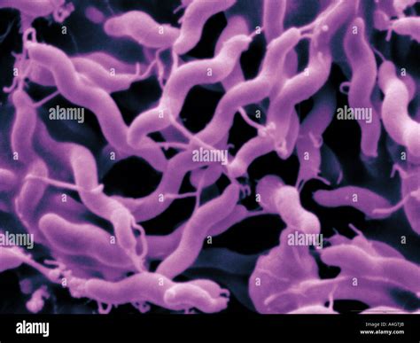 Campylobacter Jejuni Hi Res Stock Photography And Images Alamy