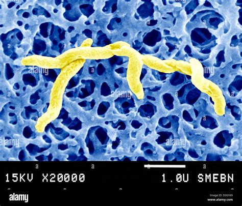 Campylobacter Jejuni Stock Photo Alamy