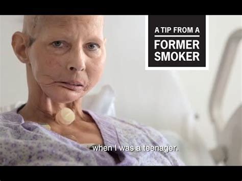 Cdc Tips From Former Smokers Terrie Teenager Ad Youtube