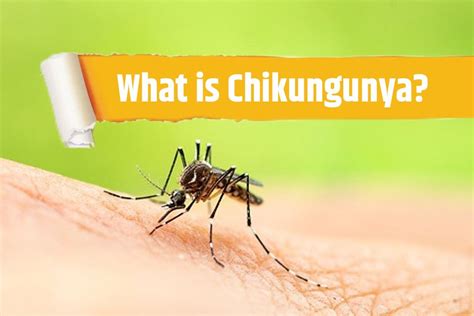 5 Ways Chikungunya Virus Travels