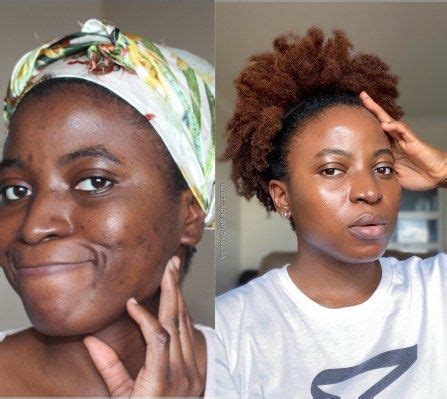 Dark Spots 5 Cheap Products That Work Hyperpigmentation Black Skin Black Skin Care Dark