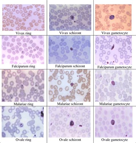 Different Stages Of Each Malaria Species Download Scientific Diagram