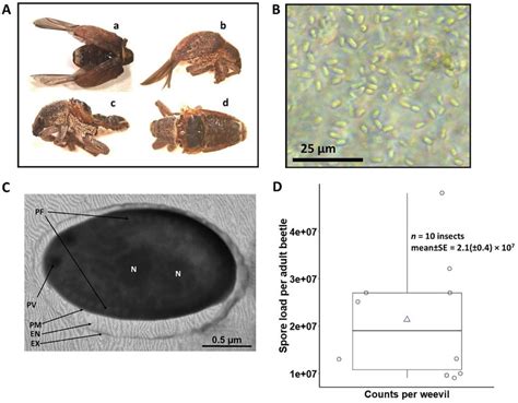 Disease Diagnosis For The New Microsporidiosis In Symptomatic Adult