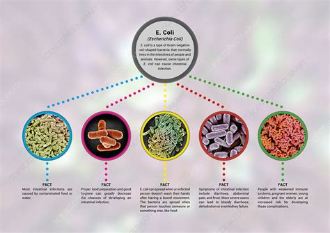 E Coli Infographic Stock Image C043 7574 Science Photo Library