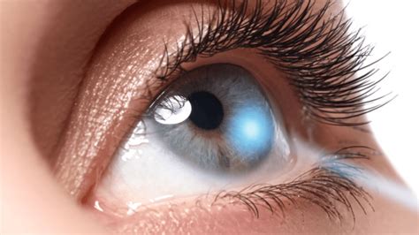 Five Things To Know About Lasik Eye Surgery Recovery Vold Vision