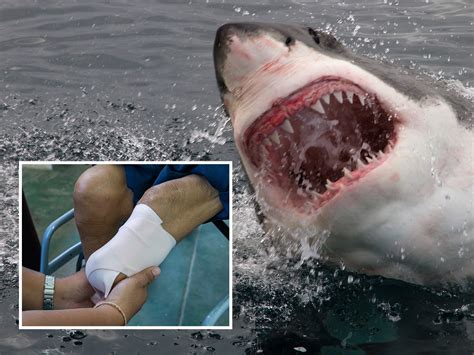 Florida Shark Attacks Yahoo Sport