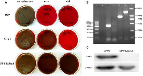 Frontiers Streptococcus Pneumoniae Attenuated Strain Spy1 With An