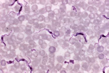 Gambar Trypanosoma Gambiense Studyhelp