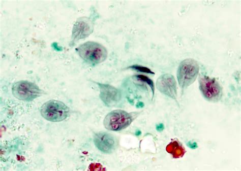 Giardia Lamblia Slide