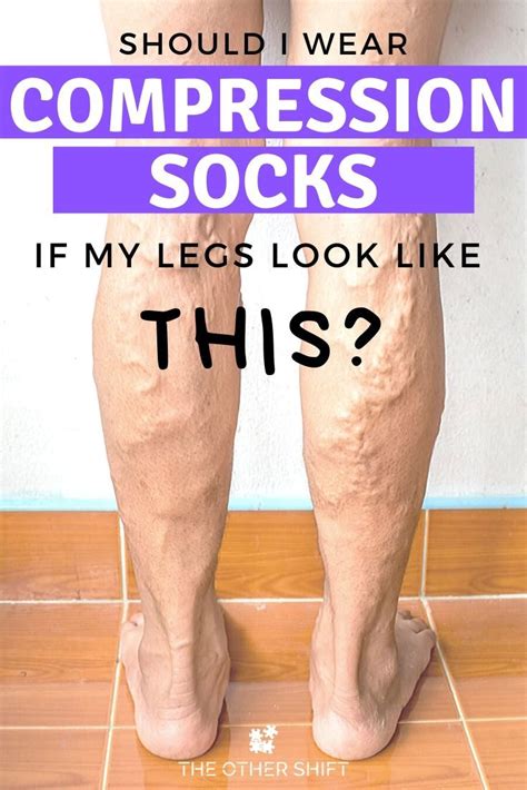 How Compression Socks Benefit Your Legs And Health