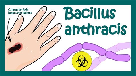 Anthrax Travel Methods