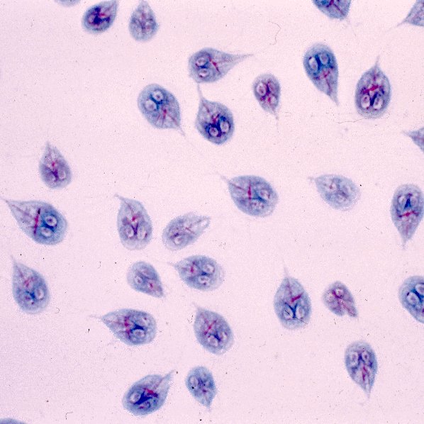 Giardia Lamblia Travel Methods