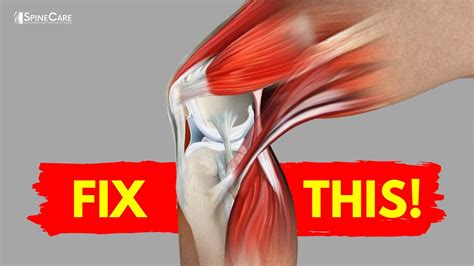 How To Fix Knee Pain The Knee Fix Movement Rx