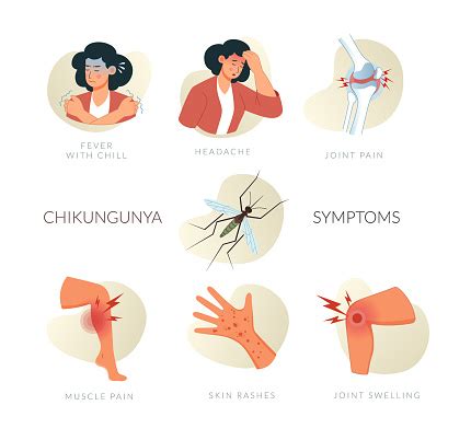 Illustrated Chikungunya Virus Symptoms With Fever And Joint Pain Stock