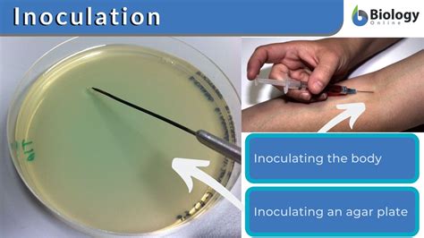 Inoculation Definition And Examples Biology Online Dictionary