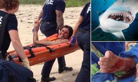 Michael Adler Florida Surfer Describes Shark Attack Which Nearly Cost