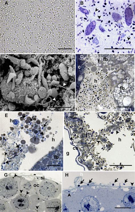 Microscopic Documentation Of Microsporidia Infection In Harmonia