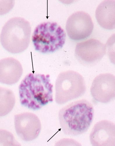 Microsporidia Flashcards