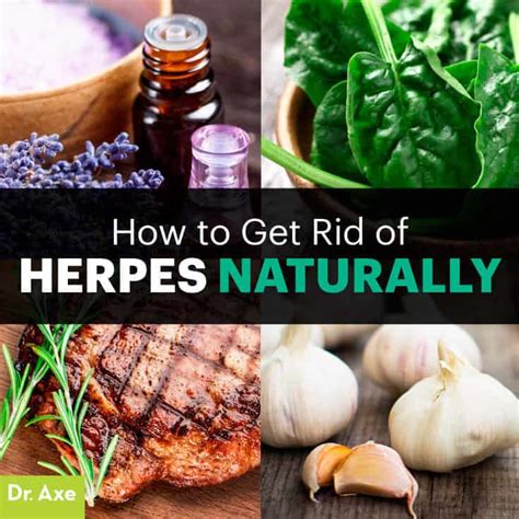 Natural Ways To Treat Herpes