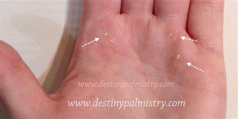 Palm Warts The Meaning In Hand Analysis Destiny Palmistry Palmistry