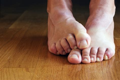 Pee Ew 8 Ways To Avoid Stinky Feet Healthy Headlines