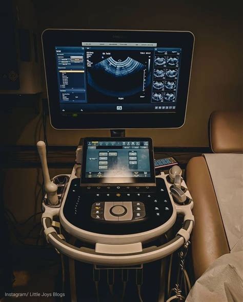 Pin By J Hernandez On Ob Sonographer Diagnostic Medical Sonography Ultrasound Diagnostic