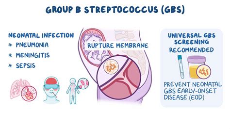 Pin On Group B Streptococcus Gbs