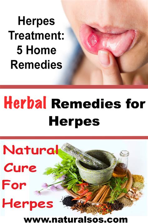 Pin On Herpes Treatment