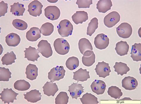 Plasmodium Protozoa Pinterest Hematology Lab Tech And Medical