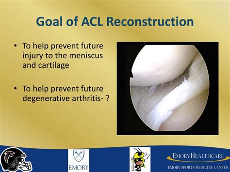 Ppt Acl Reconstruction The Anatomic Approach Powerpoint Presentation