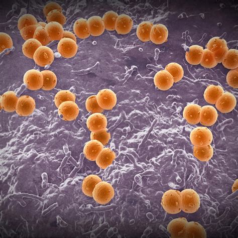 Rise In Rare Bacterial Illness Raises Concerns About Meningococcal Disease Cdc Warns World