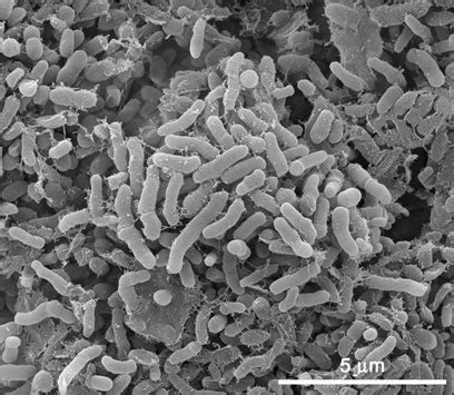 Sem Image Showing Attachment And Biofilm Formation By Escherichia Coli