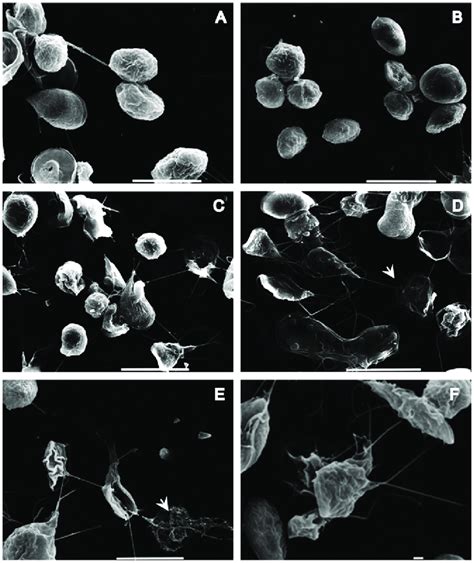 Sem Micrographs Of Giardia Lamblia Cysts Treated With Cd And La