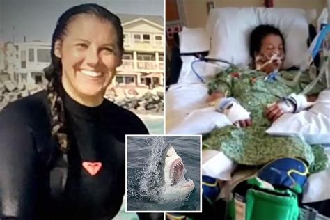 Shark Attack Victim Tells How She Tore At A Great White Amp 39 S Eyes With Her Fingers After It Dragged