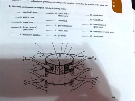 Solved Collection Of Spinal Nerves Traveling In The Vertebral Canal