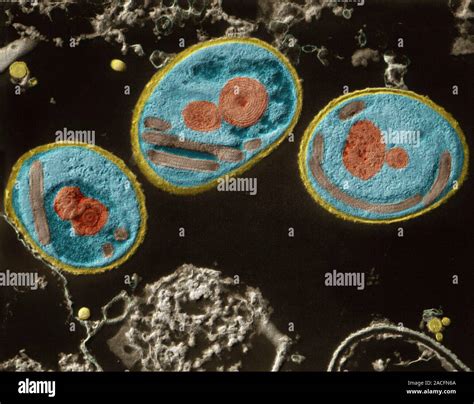 Spore Forming Parasites Coloured Transmission Electron Micrograph Tem