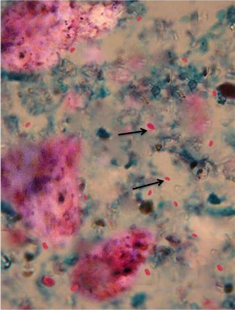 The Microsporidia Spores In The Stool Sample Of Exotic Birds That Were