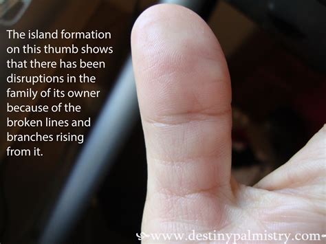 Thumb Lines Explained In A Palmistry Study Destiny Palmistry