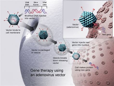 Uniqure S Amt 130 Receives Fda Orphan Drug Designation In Huntington S Disease European