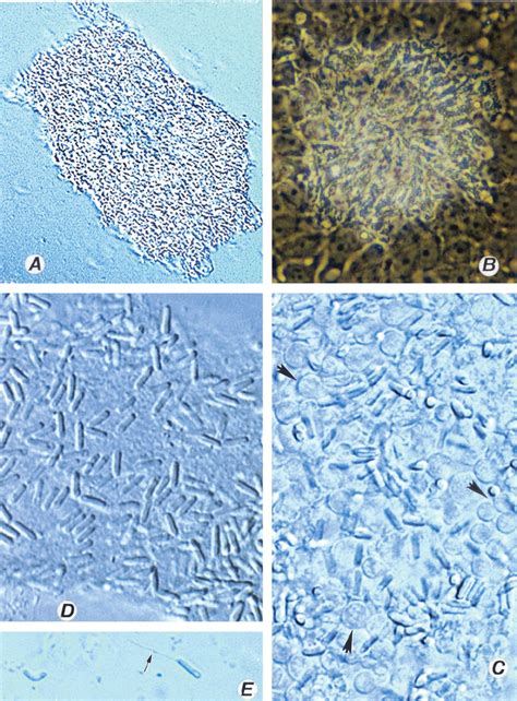 Vittaforma Corneae Is A Human Infecting Microsporidia Species V Corneae Can Cause Eye