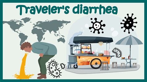 What Is Traveler S Diarrhea Youtube