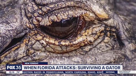 When Florida Attacks Surviving An Alligator Attack Youtube